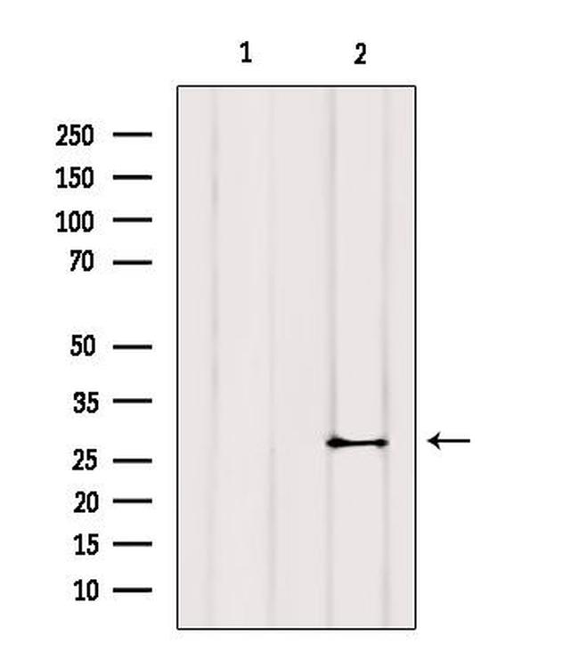 Cardiac Troponin I Antibody in Western Blot (WB)