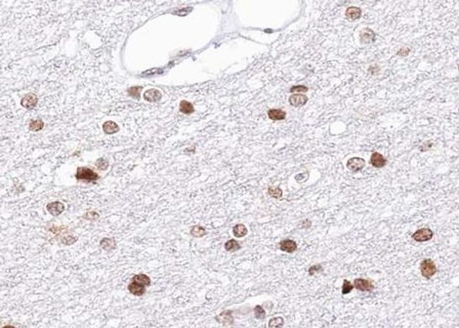 BRCA1 Antibody in Immunohistochemistry (Paraffin) (IHC (P))