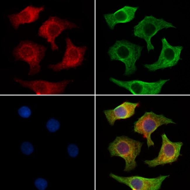 GSK3 alpha/beta Antibody in Immunocytochemistry (ICC/IF)