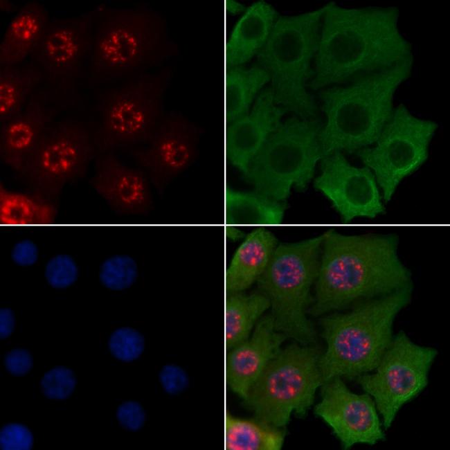 Ataxin 1 Antibody in Immunocytochemistry (ICC/IF)