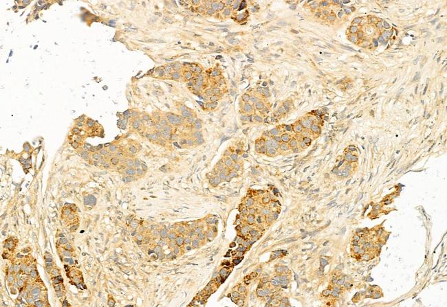 MEK1/MEK2 Antibody in Immunohistochemistry (Paraffin) (IHC (P))