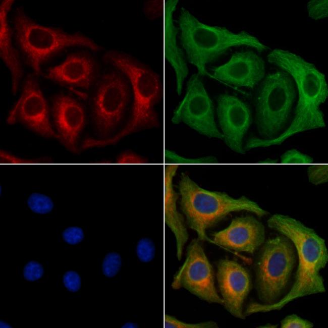 HSL Antibody in Immunocytochemistry (ICC/IF)