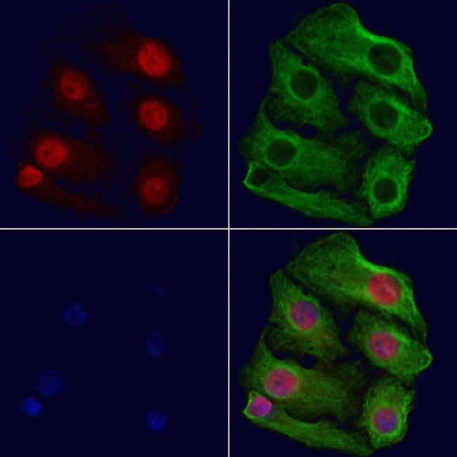 BIK Antibody in Immunocytochemistry (ICC/IF)