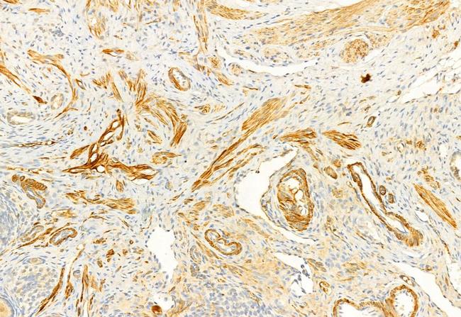 TIMP1 Antibody in Immunohistochemistry (Paraffin) (IHC (P))