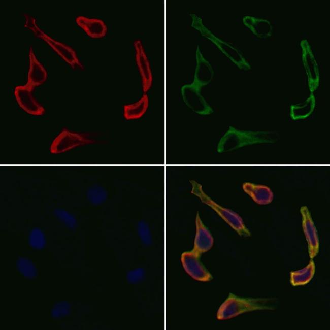 VEGFB Antibody in Immunocytochemistry (ICC/IF)