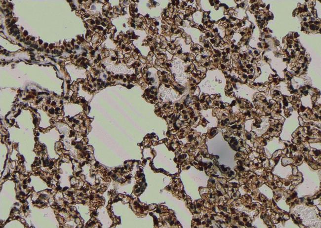 Phospho-TrkC (Tyr705) Antibody in Immunohistochemistry (Paraffin) (IHC (P))