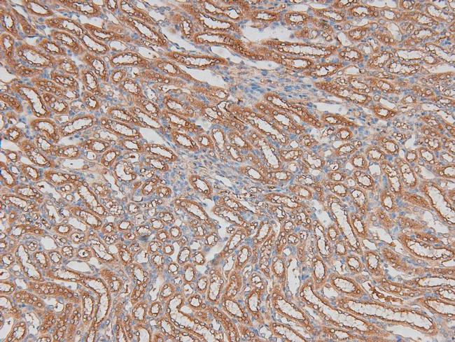 Phospho-ILK (Ser343) Antibody in Immunohistochemistry (Paraffin) (IHC (P))