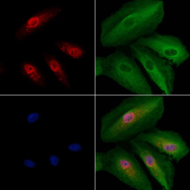 v-Myb Antibody in Immunocytochemistry (ICC/IF)