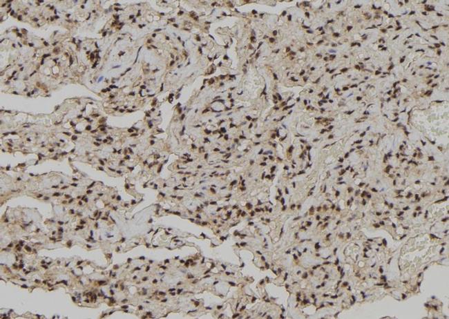 C/EBP zeta Antibody in Immunohistochemistry (Paraffin) (IHC (P))