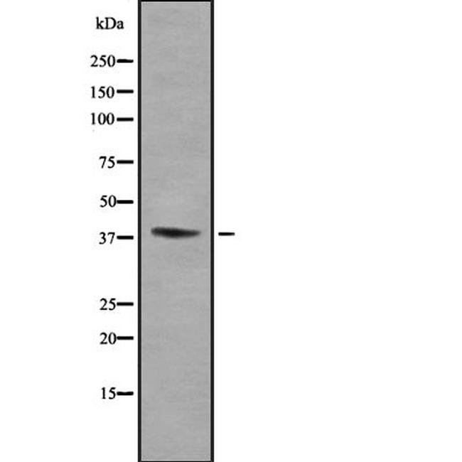 KIR2DL5B Antibody in Western Blot (WB)