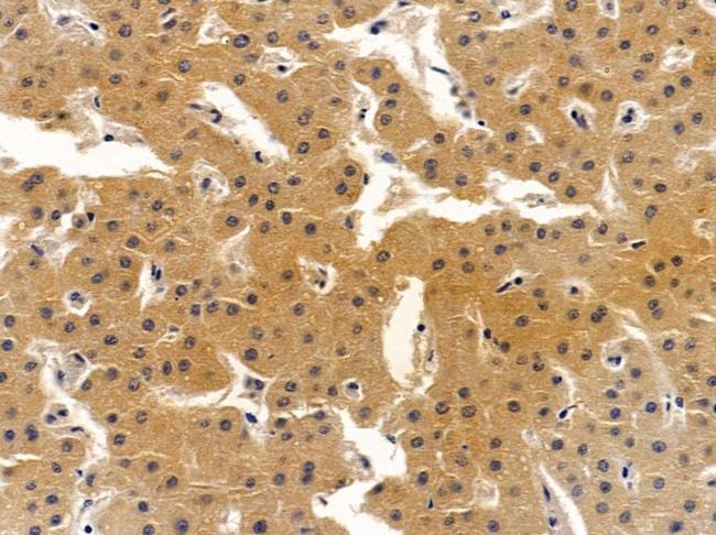 CYP4F2 Antibody in Immunohistochemistry (Paraffin) (IHC (P))