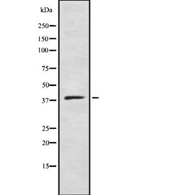 ZDHHC9 Antibody in Western Blot (WB)