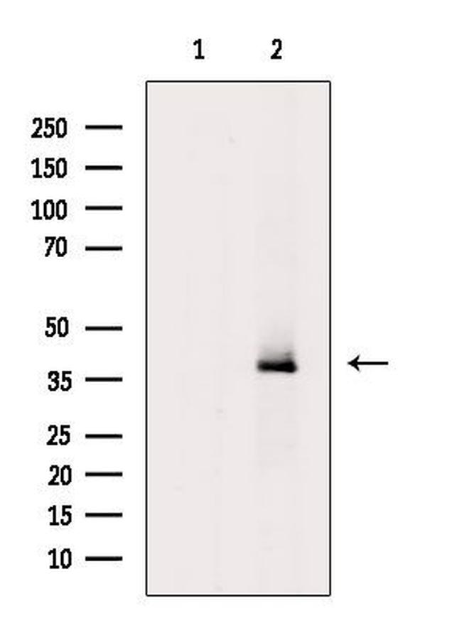 GPR41 Antibody in Western Blot (WB)