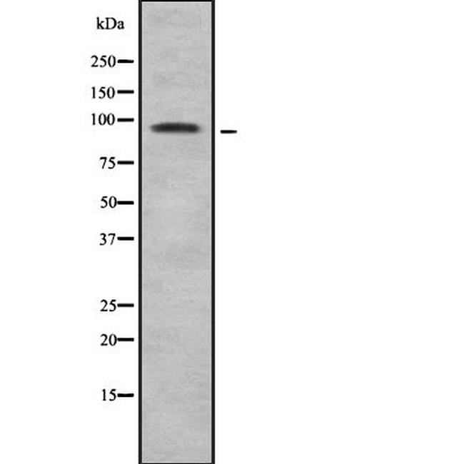 LONP2 Antibody in Western Blot (WB)