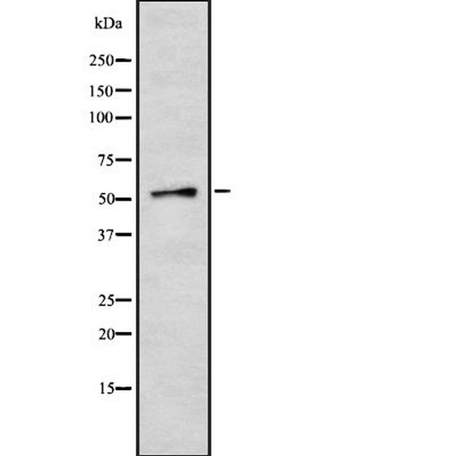 SLC16A12 Antibody in Western Blot (WB)