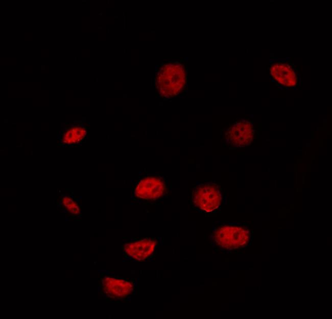 DUSP4 Antibody in Immunocytochemistry (ICC/IF)