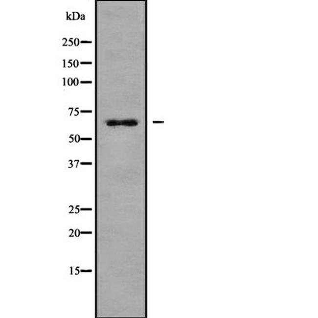 NOX3 Antibody in Western Blot (WB)