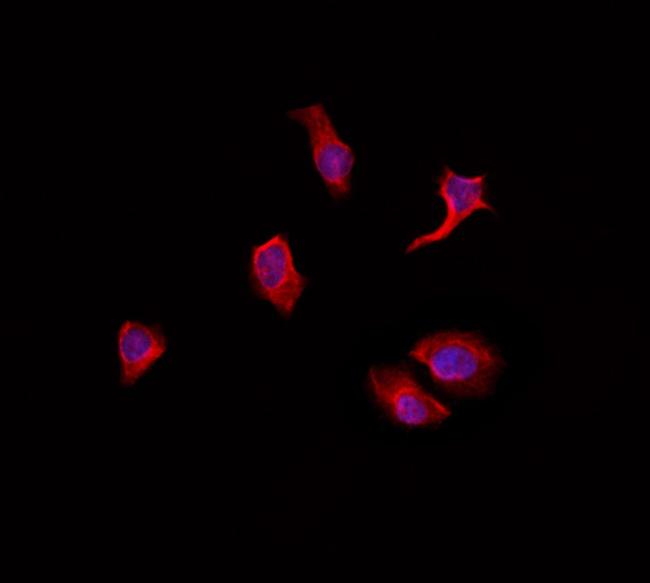 OCT6 Antibody in Immunocytochemistry (ICC/IF)