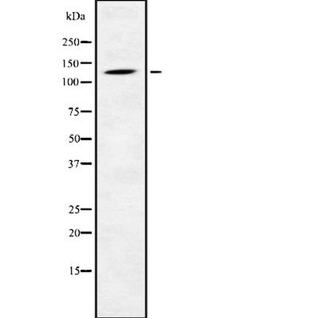 PHKB Antibody in Western Blot (WB)