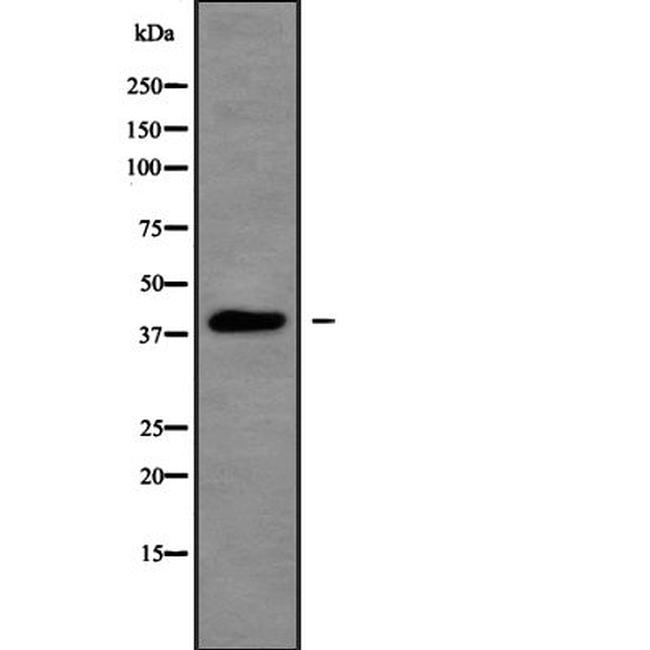 PKA alpha/beta/gamma Antibody in Western Blot (WB)