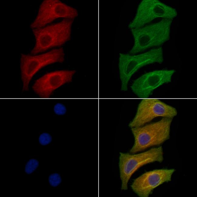 RAB34 Antibody in Immunocytochemistry (ICC/IF)