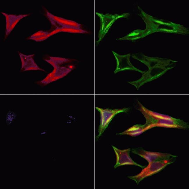 RhoG Antibody in Immunocytochemistry (ICC/IF)