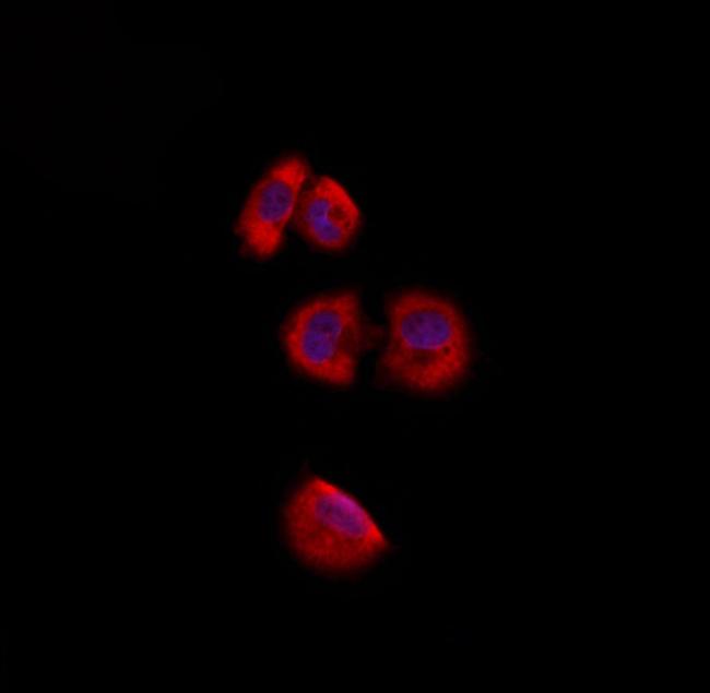 RPS2 Antibody in Immunocytochemistry (ICC/IF)