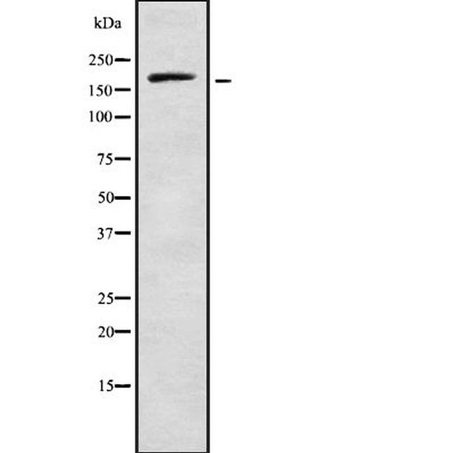 RREB1 Antibody in Western Blot (WB)