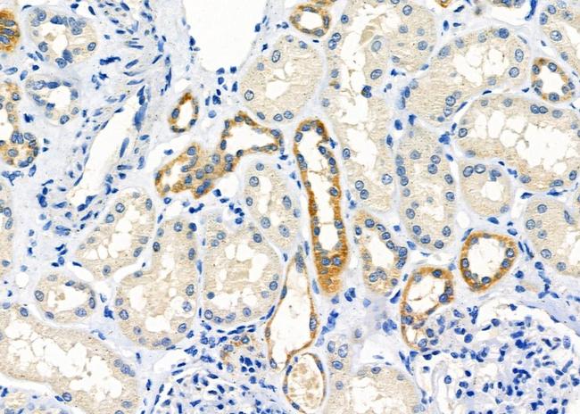 STAM2 Antibody in Immunohistochemistry (Paraffin) (IHC (P))