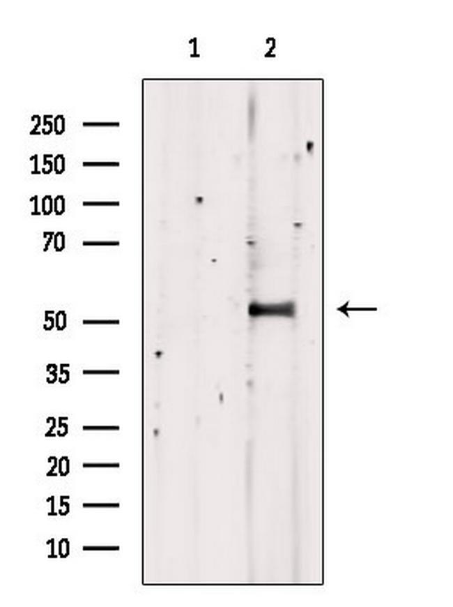 TDE1 Antibody in Western Blot (WB)