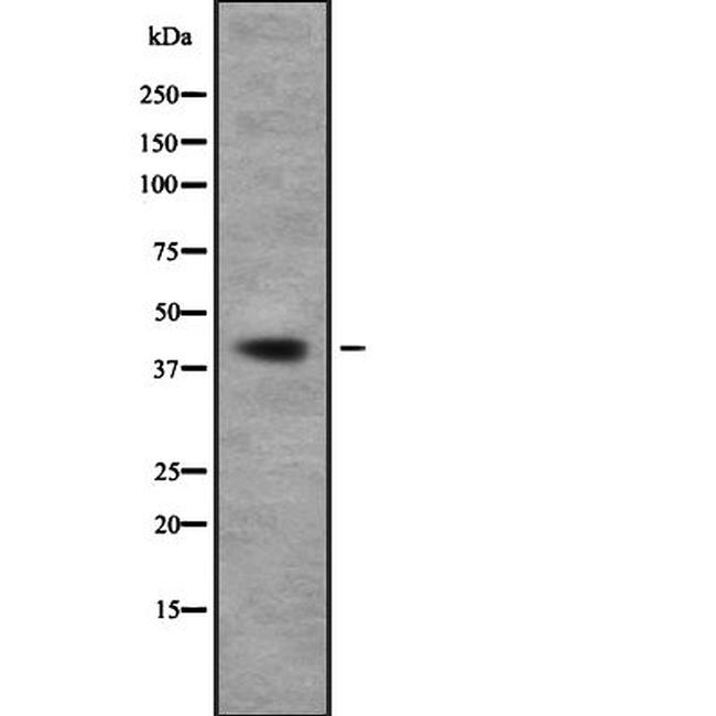 TOB1 Antibody in Western Blot (WB)