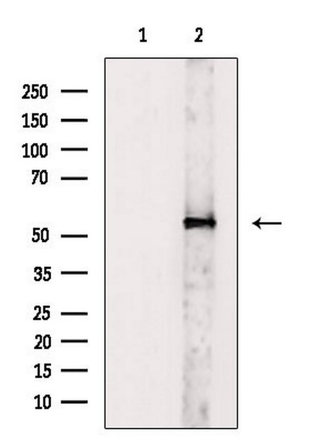 V-ATPase H Antibody in Western Blot (WB)