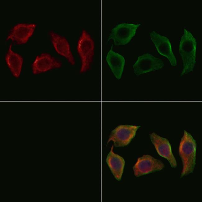 CaV2.3 Antibody in Immunocytochemistry (ICC/IF)