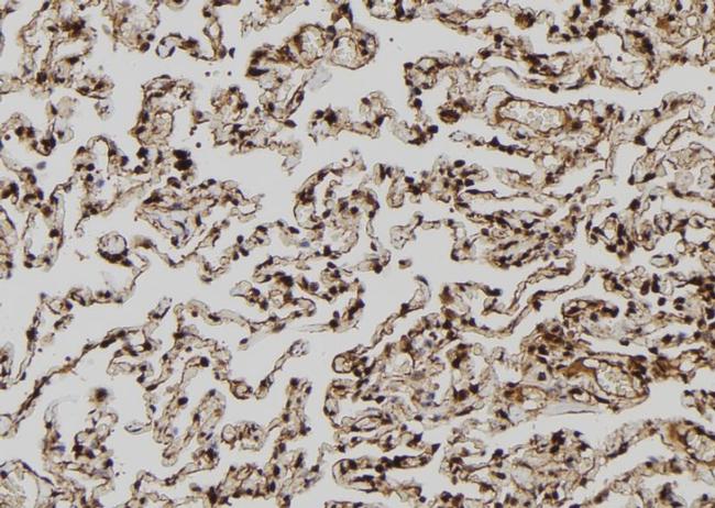 MAGEA8 Antibody in Immunohistochemistry (Paraffin) (IHC (P))