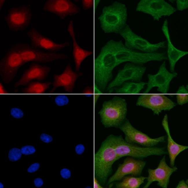 MAGEB6 Antibody in Immunocytochemistry (ICC/IF)