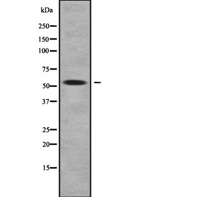 ZNF25 Antibody in Western Blot (WB)