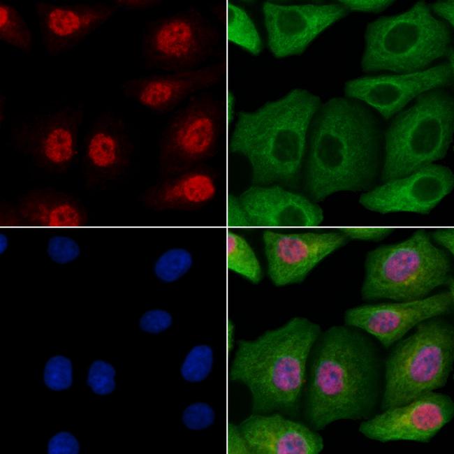 ZNF227 Antibody in Immunocytochemistry (ICC/IF)