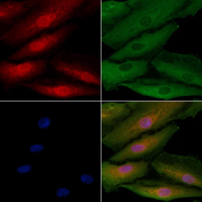 ASPM Antibody in Immunocytochemistry (ICC/IF)