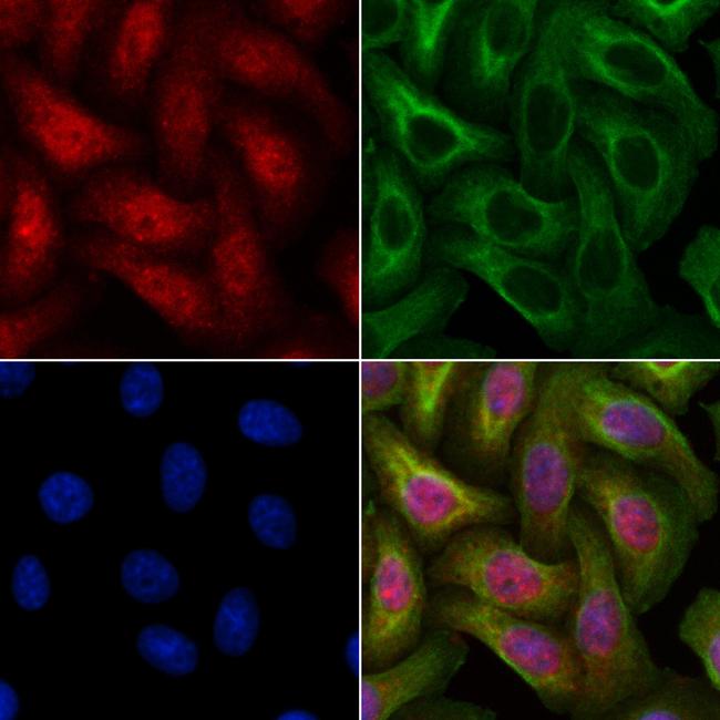 PPP1R9B Antibody in Immunocytochemistry (ICC/IF)