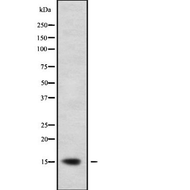 GILZ Antibody in Western Blot (WB)