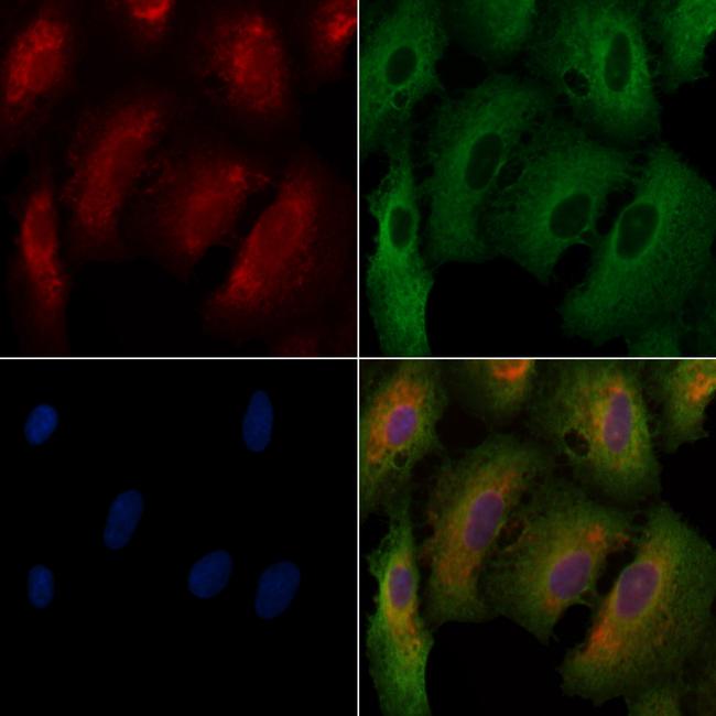 CYBA Antibody in Immunocytochemistry (ICC/IF)