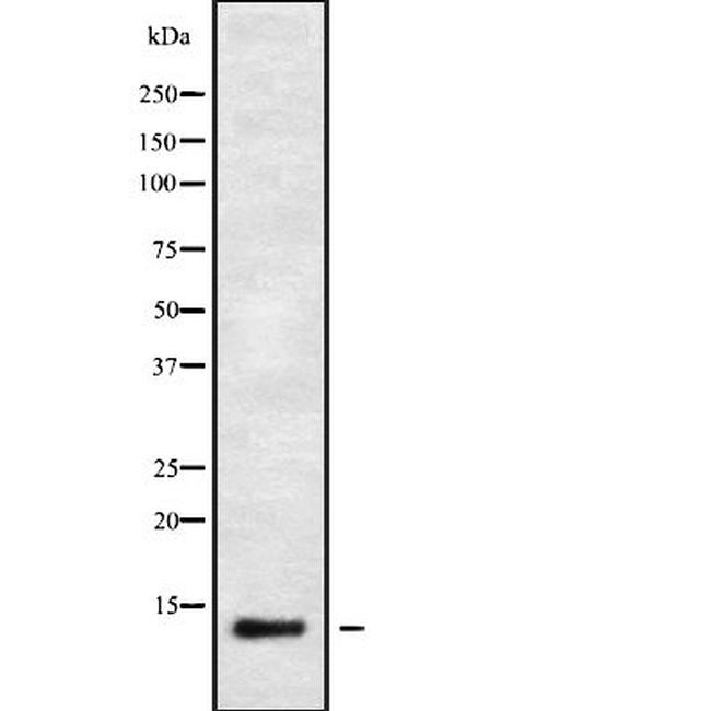 IFI6 Antibody in Western Blot (WB)