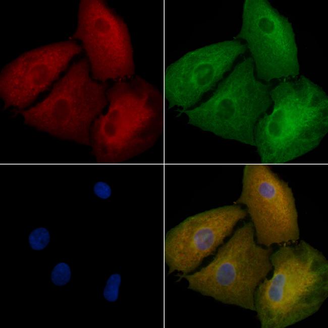 STRN Antibody in Immunocytochemistry (ICC/IF)