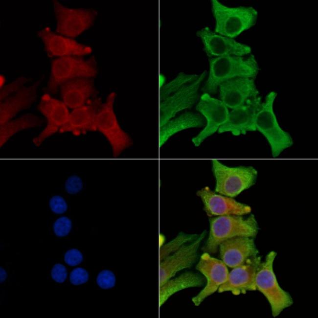 NPR1 Antibody in Immunocytochemistry (ICC/IF)