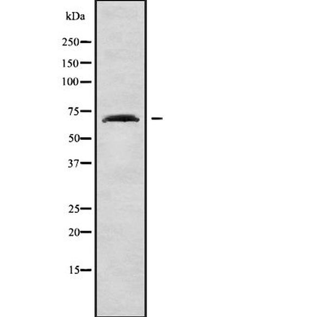 TCCR Antibody in Western Blot (WB)