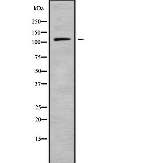 PSD4 Antibody in Western Blot (WB)