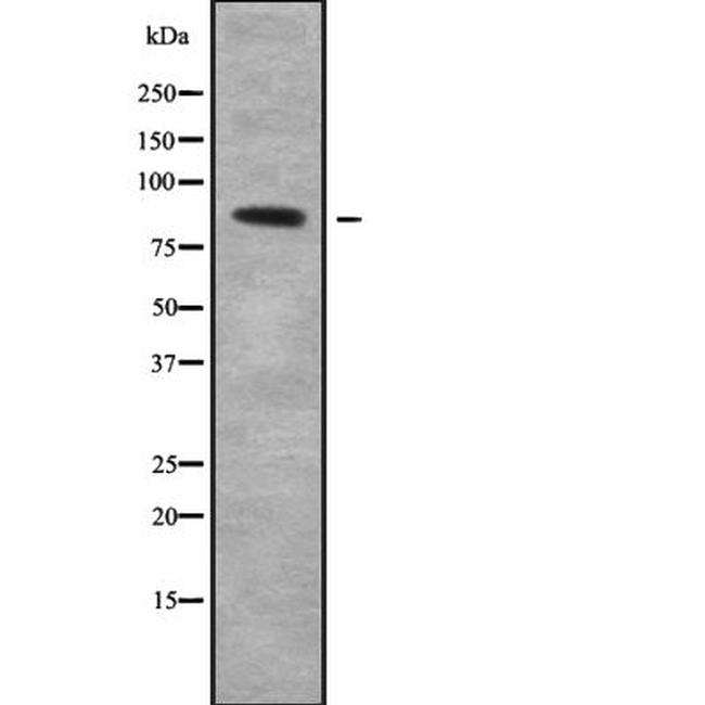 COLEC12 Antibody in Western Blot (WB)