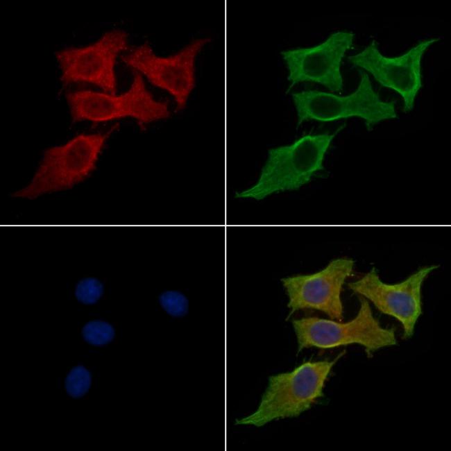 Opticin Antibody in Immunocytochemistry (ICC/IF)