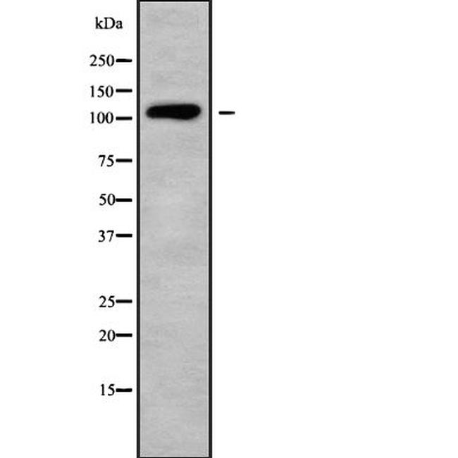 SEMA6D Antibody in Western Blot (WB)