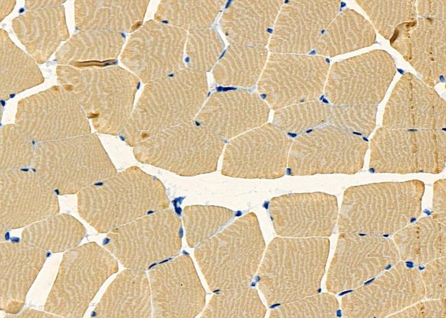 CELSR1 Antibody in Immunohistochemistry (Paraffin) (IHC (P))